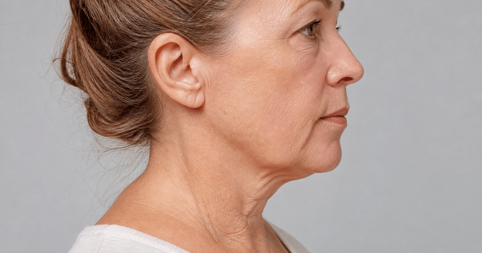 Do You Need a Neck Lift? Here’s How to Actually Know