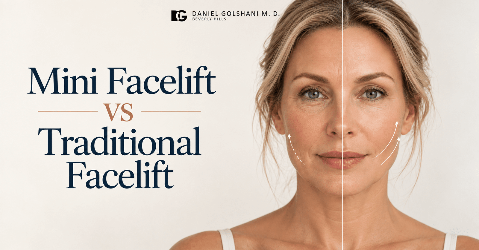 Mini Facelift vs. Traditional Facelift: Key Differences Explained
